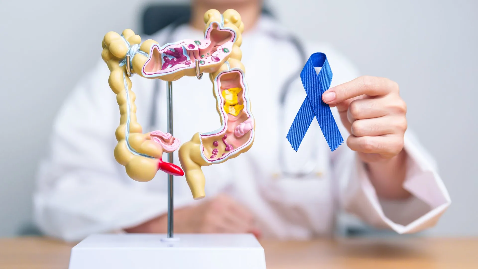 Colon Cancer